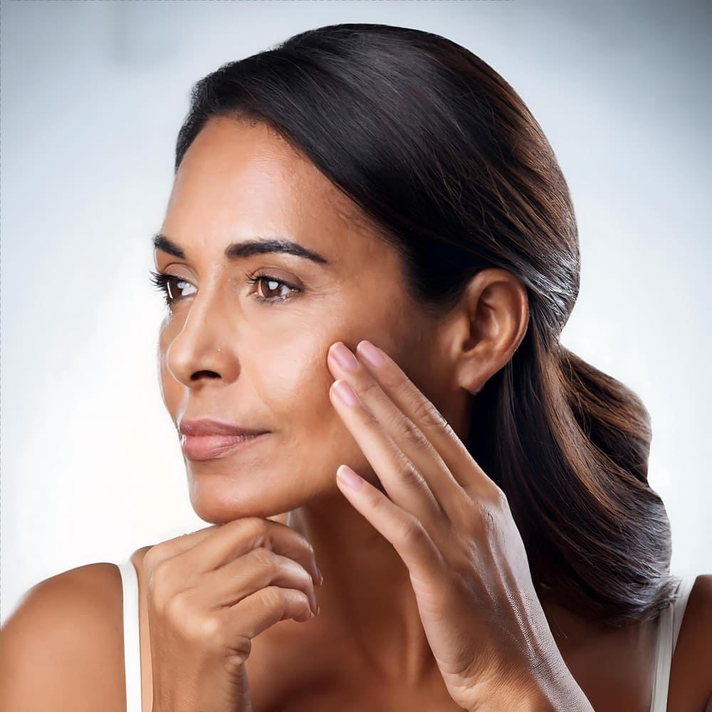 After treatment — skin firmer and lifted
