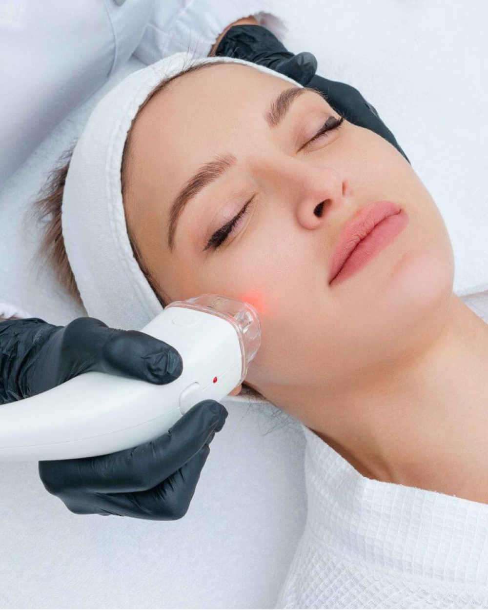 Acne and Blemish Treatments Florida