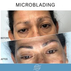 before and after microblading