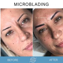 before and after microblading